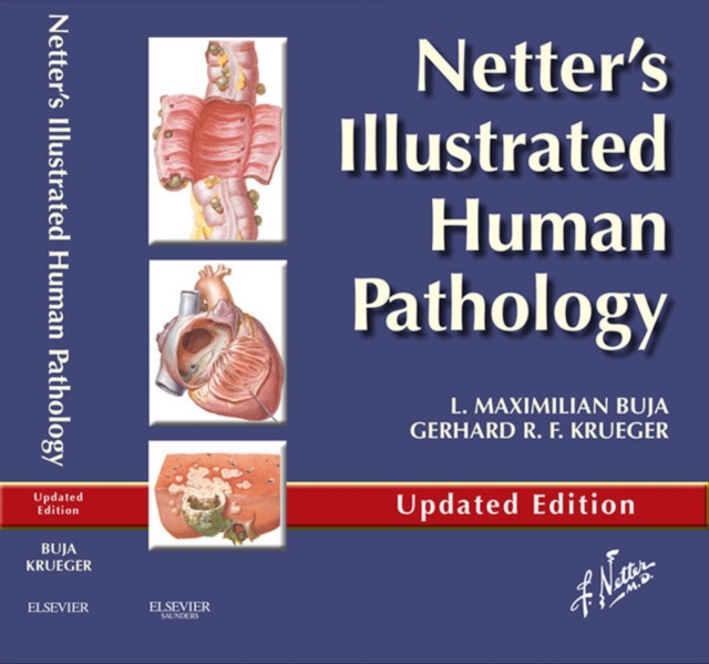 Netter's Illustrated Human Pathology Updated Edition E-book : Netter's Illustrated Human Pathology Updated Edition E-book, EPUB eBook