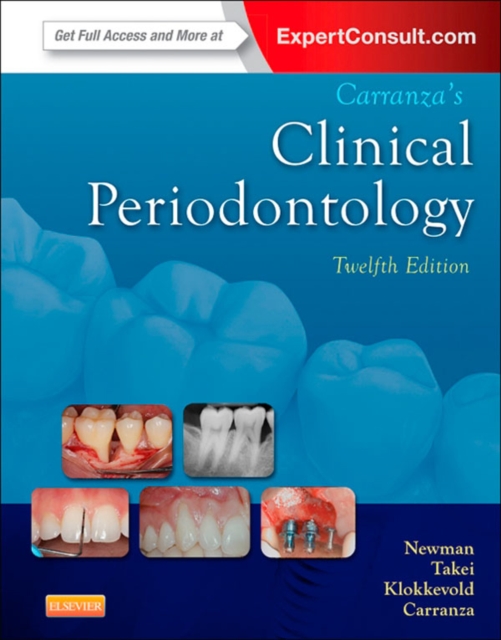 Carranza's Clinical Periodontology - E-Book : Expert Consult: Online, EPUB eBook