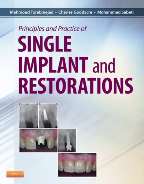 Principles and Practice of Single Implant and Restoration, EPUB eBook