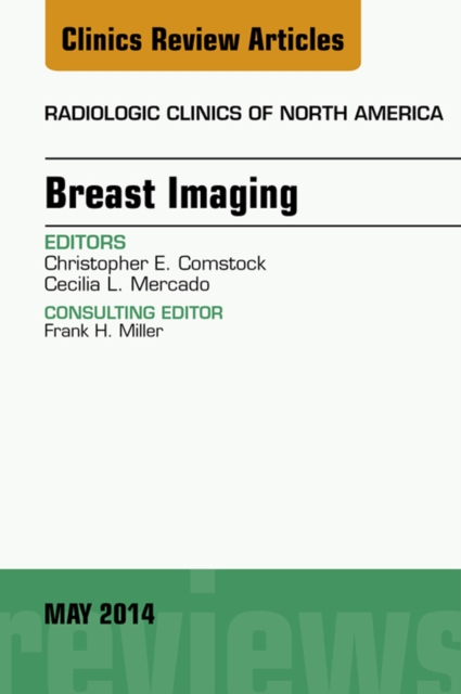 Breast Imaging, An Issue of Radiologic Clinics of North America, E-Book, EPUB eBook