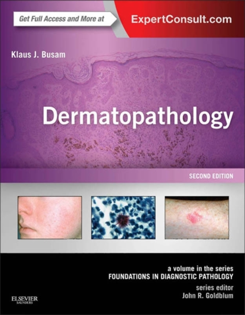 Dermatopathology E-Book : A Volume in the Series: Foundations in Diagnostic Pathology (Expert Consult - Online), EPUB eBook