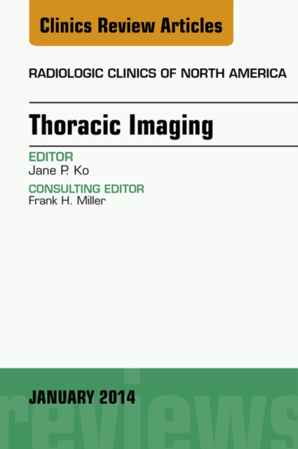 Thoracic Imaging, An Issue of Radiologic Clinics of North America, E-Book : Thoracic Imaging, An Issue of Radiologic Clinics of North America, E-Book, EPUB eBook