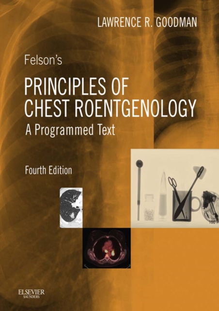 Felson's Principles of Chest Roentgenology E-Book, EPUB eBook