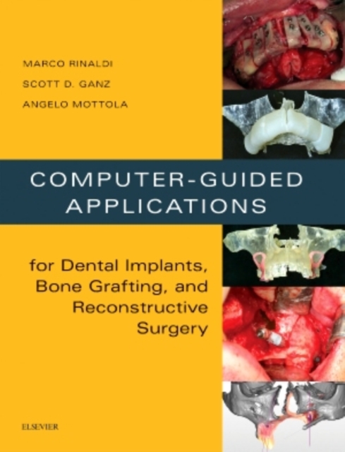 Computer-Guided Applications for Dental Implants, Bone Grafting, and Reconstructive Surgery (adapted translation), Hardback Book
