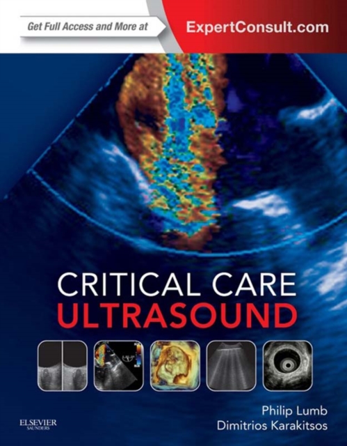 Critical Care Ultrasound E-Book, EPUB eBook