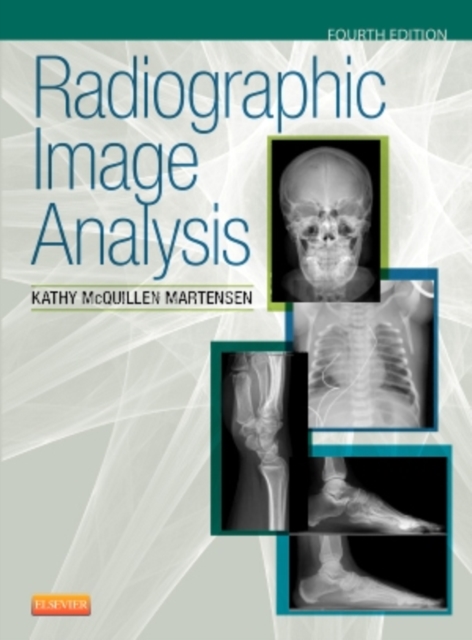 Radiographic Image Analysis, Hardback Book