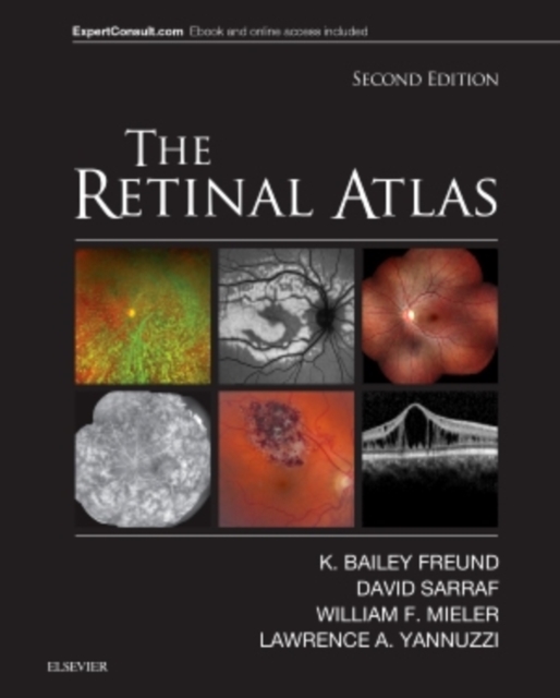 The Retinal Atlas, Hardback Book