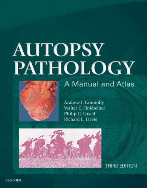Autopsy Pathology: A Manual and Atlas, EPUB eBook
