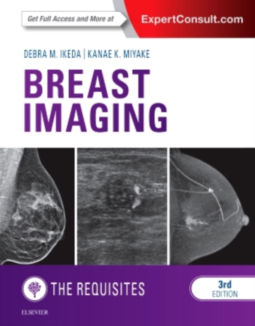 Breast Imaging: The Requisites, Hardback Book