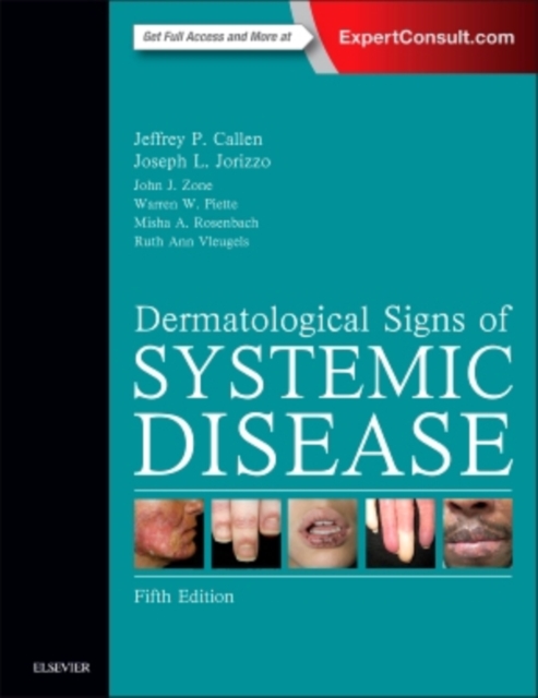 Dermatological Signs of Systemic Disease, Hardback Book
