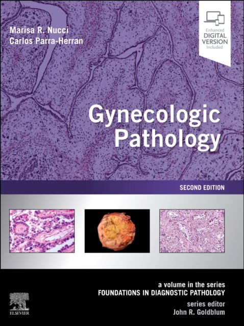 Gynecologic Pathology : A Volume in Foundations in Diagnostic Pathology Series, Hardback Book
