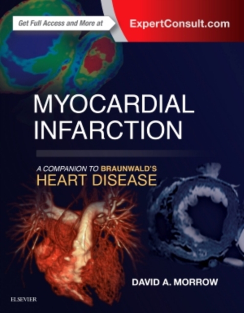 Myocardial Infarction: A Companion to Braunwald's Heart Disease, Hardback Book
