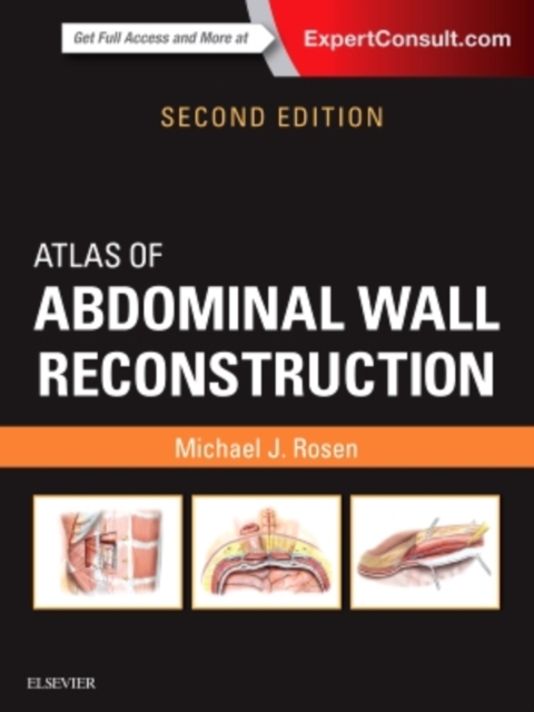 Atlas of Abdominal Wall Reconstruction, Hardback Book
