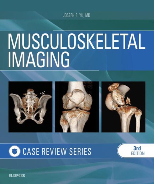 Musculoskeletal Imaging: Case Review Series E-Book, EPUB eBook