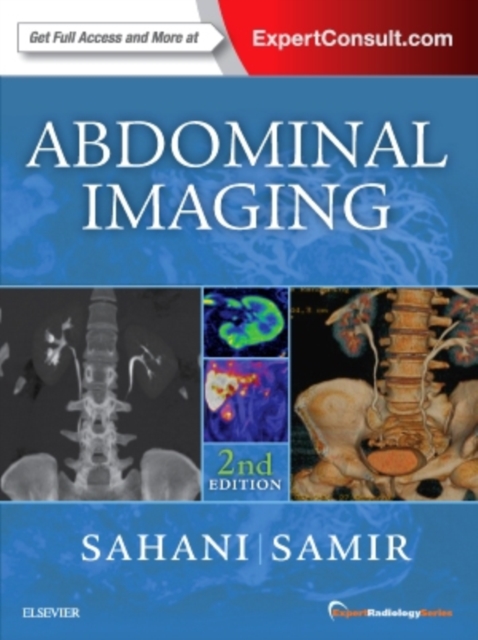 Abdominal Imaging : Expert Radiology Series, Hardback Book