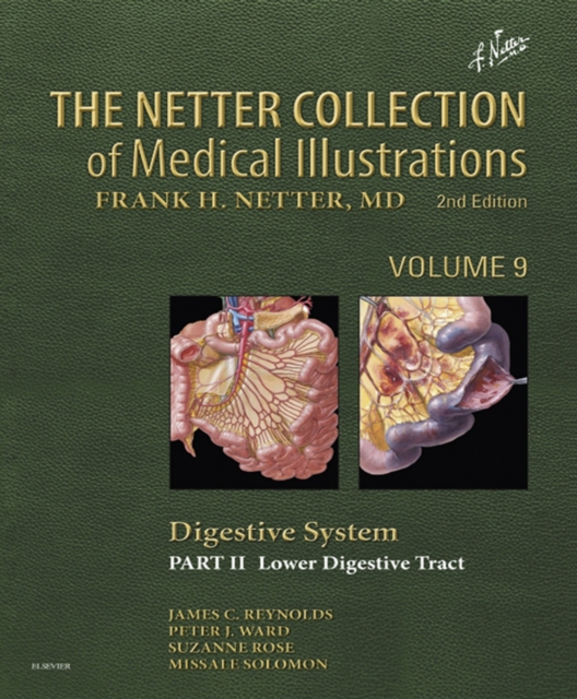 The Netter Collection of Medical Illustrations: Digestive System: Part II - Lower Digestive Tract, EPUB eBook