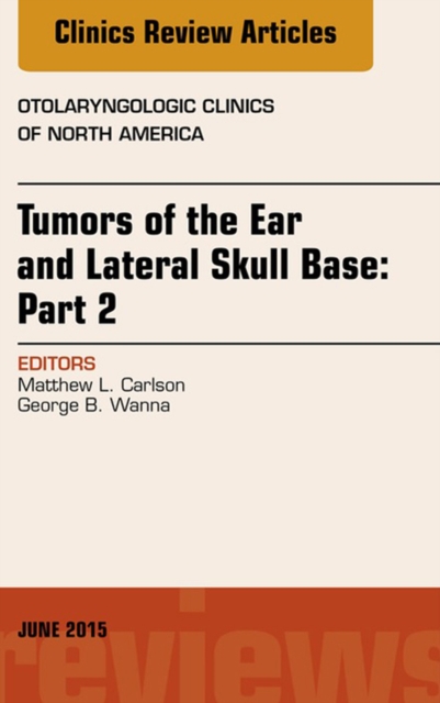 Tumors of the Ear and Lateral Skull Base: PART 2, An Issue of Otolaryngologic Clinics of North America, EPUB eBook