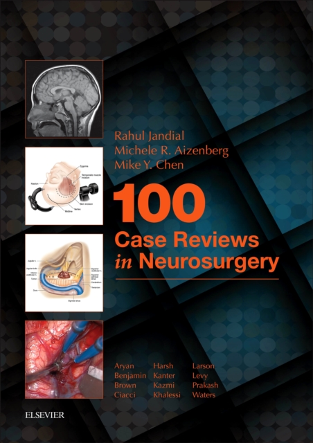 100 Case Reviews in Neurosurgery, EPUB eBook