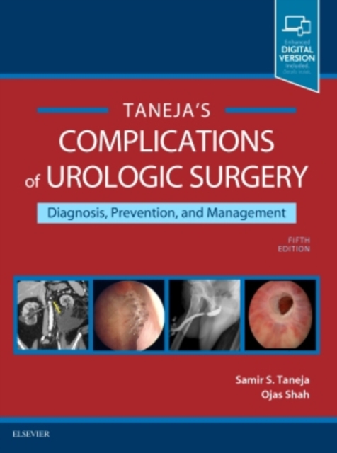 Complications of Urologic Surgery : Prevention and Management, Hardback Book