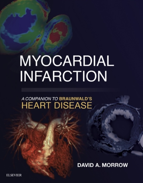 Myocardial Infarction: A Companion to Braunwald's Heart Disease E-Book, EPUB eBook