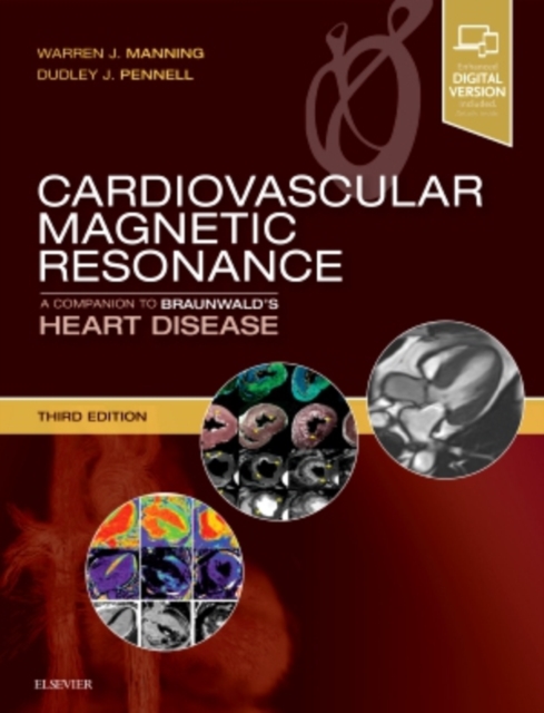 Cardiovascular Magnetic Resonance : A Companion to Braunwald's Heart Disease, Hardback Book