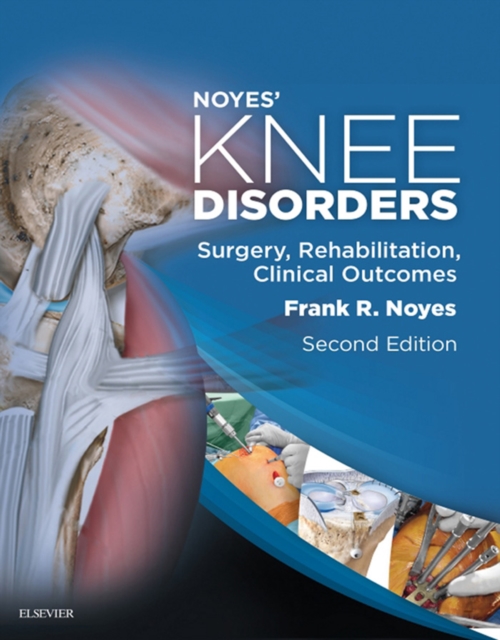Noyes' Knee Disorders: Surgery, Rehabilitation, Clinical Outcomes E-Book, EPUB eBook
