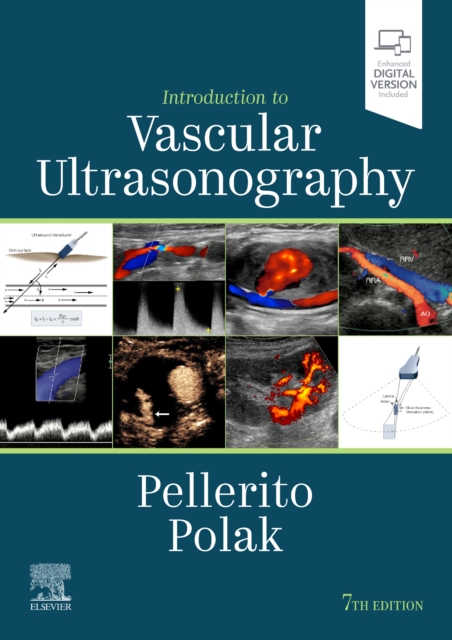 Introduction to Vascular Ultrasonography, Hardback Book