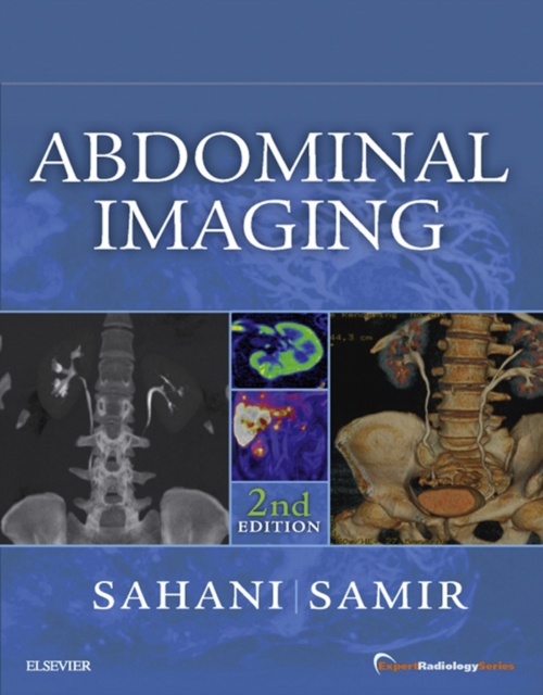 Abdominal Imaging E-Book : Expert Radiology Series, EPUB eBook