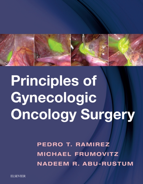 Principles of Gynecologic Oncology Surgery E-Book, EPUB eBook