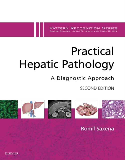 Practical Hepatic Pathology: A Diagnostic Approach : A Volume in the Pattern Recognition Series, EPUB eBook