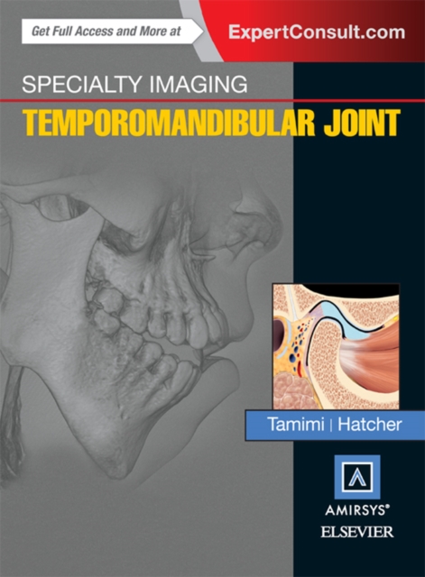 Specialty Imaging: Temporomandibular Joint : Specialty Imaging: Temporomandibular Joint E-Book, EPUB eBook