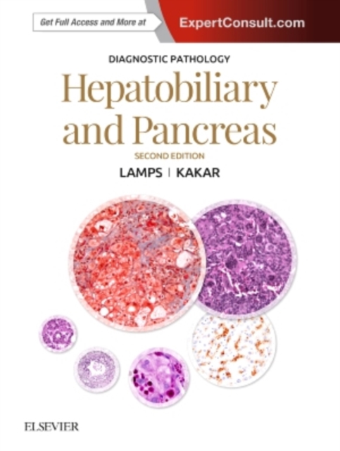 Diagnostic Pathology: Hepatobiliary and Pancreas, Hardback Book
