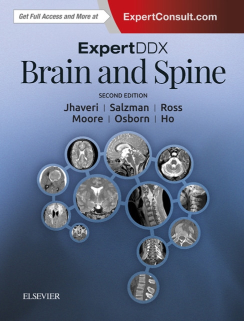 ExpertDDx: Brain and Spine : ExpertDDx: Brain and Spine E-Book, EPUB eBook