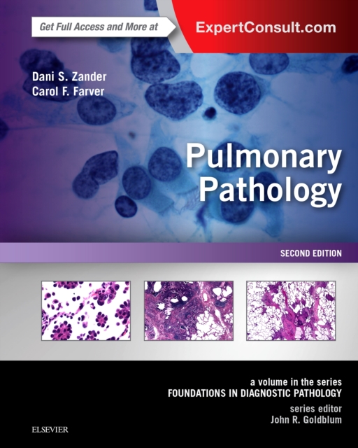 Pulmonary Pathology : A Volume in Foundations in Diagnostic Pathology Series, PDF eBook