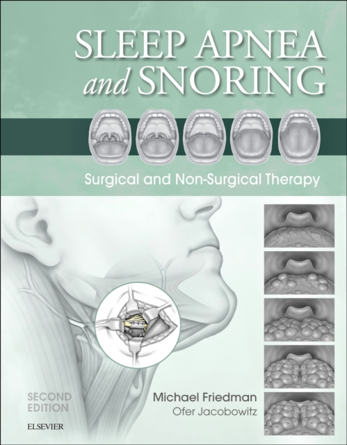 Sleep Apnea and Snoring E-Book : Sleep Apnea and Snoring E-Book, EPUB eBook