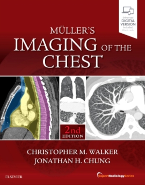 Muller's Imaging of the Chest : Expert Radiology Series, Hardback Book