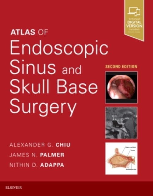 Atlas of Endoscopic Sinus and Skull Base Surgery, Hardback Book