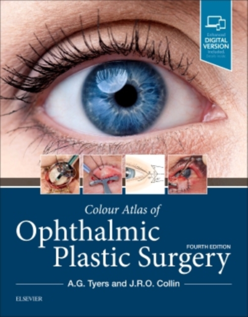 Colour Atlas of Ophthalmic Plastic Surgery, Hardback Book