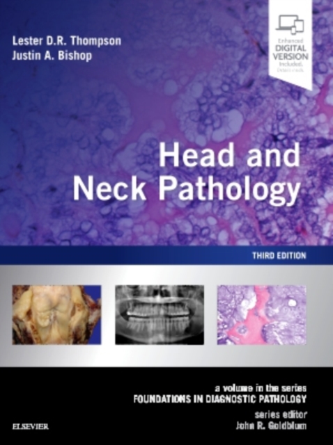 Head and Neck Pathology : A Volume in the Series: Foundations in Diagnostic Pathology, Hardback Book