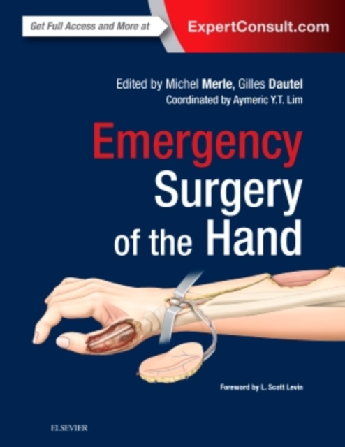 Emergency Surgery of the Hand, Hardback Book