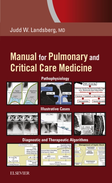 Manual for Pulmonary and Critical Care Medicine E-Book, EPUB eBook