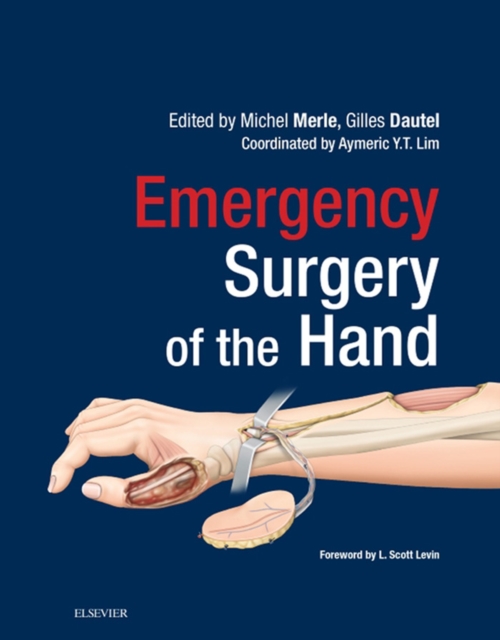 Emergency Surgery of the Hand, EPUB eBook