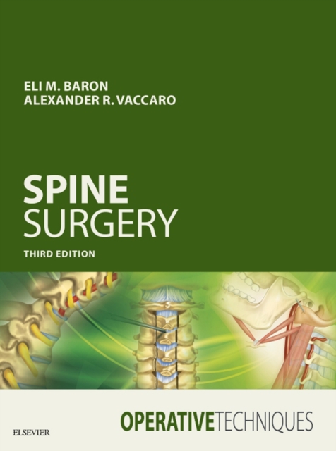 Operative Techniques: Spine Surgery, EPUB eBook