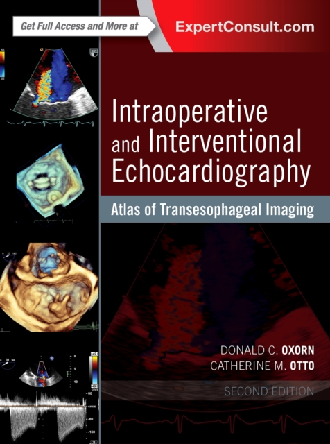 Intraoperative and Interventional Echocardiography : Atlas of Transesophageal Imaging E-Book, PDF eBook
