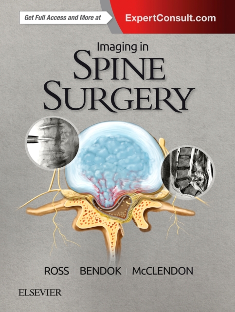 Imaging in Spine Surgery : Imaging in Spine Surgery E-Book, PDF eBook