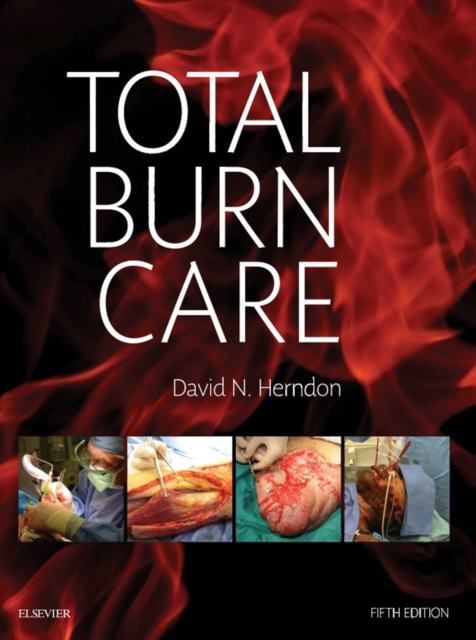 Total Burn Care E-Book, EPUB eBook