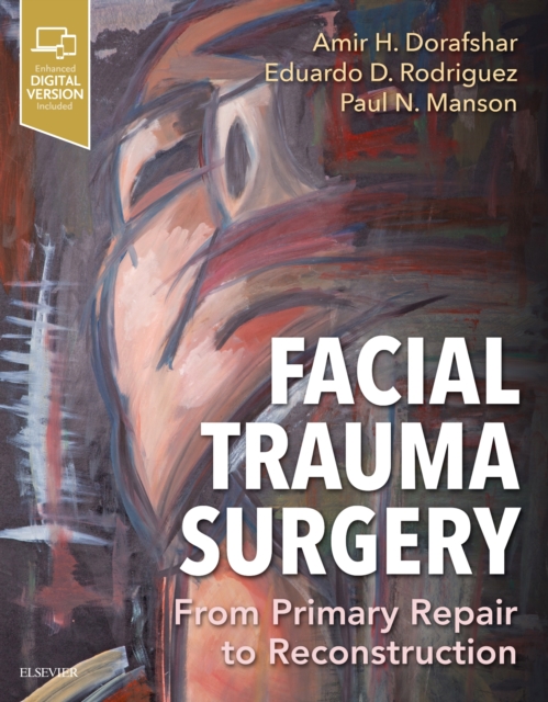 Facial Trauma Surgery : From Primary Repair to Reconstruction, Hardback Book