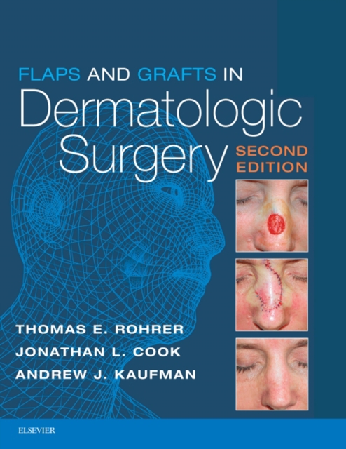 Flaps and Grafts in Dermatologic Surgery E-Book, EPUB eBook