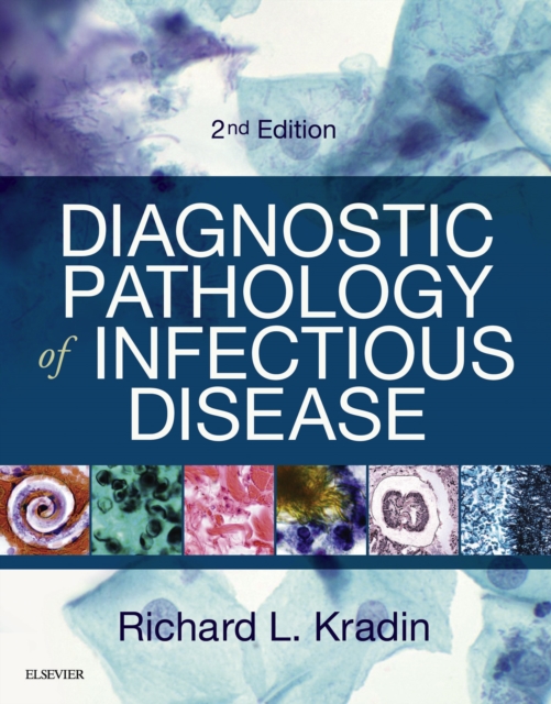Diagnostic Pathology of Infectious Disease E-Book, EPUB eBook