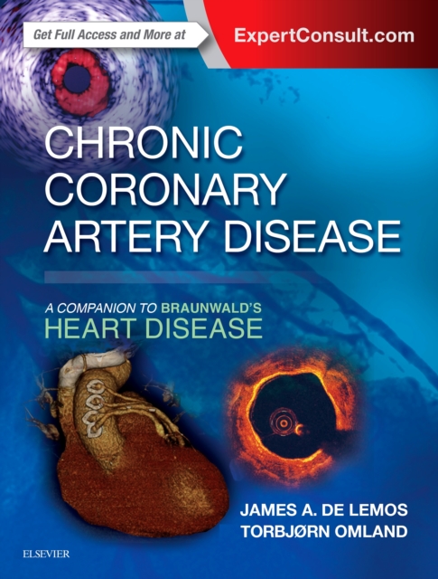 Chronic Coronary Artery Disease: A Companion to Braunwald's Heart Disease E-Book : A Companion to Braunwald's Heart Disease, EPUB eBook